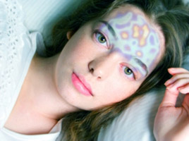 Epilepsia